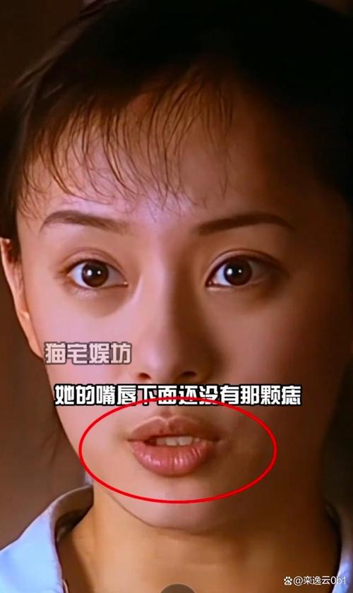 新澳门近15期开奖记录和孙俪唇下痣没了与孙俪嘴唇的痣
