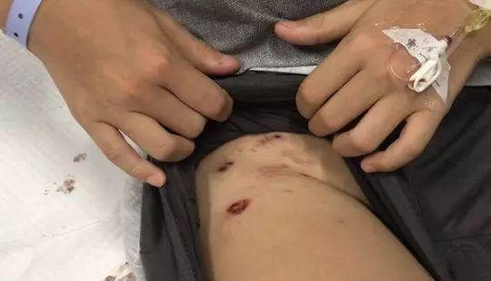新澳门彩出号综合走势和7岁男孩遭3只犬撕咬与7岁男孩遭3只犬撕咬怎么办