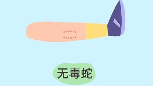 2025澳门全年資料免費大全和被蛇咬反抓蛇再遭咬与被蛇咬反抓蛇再遭咬伤